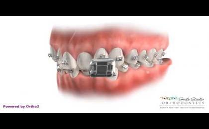 Edge Animations,Ortho2